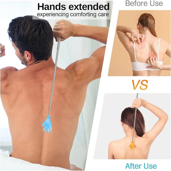 Colorful Extendable Back Scratchers - 100 Pcs in Yellow & Blue for Itch Relief